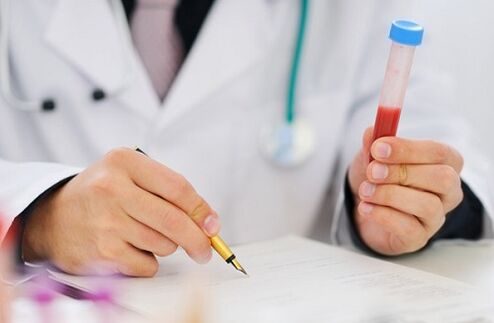 prostatitis tests for prescribing drugs